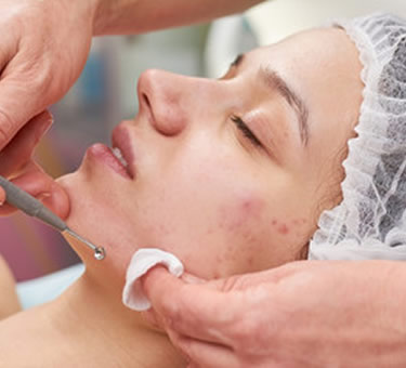 Esthetician performing an acne facial treatment on a client in Houston