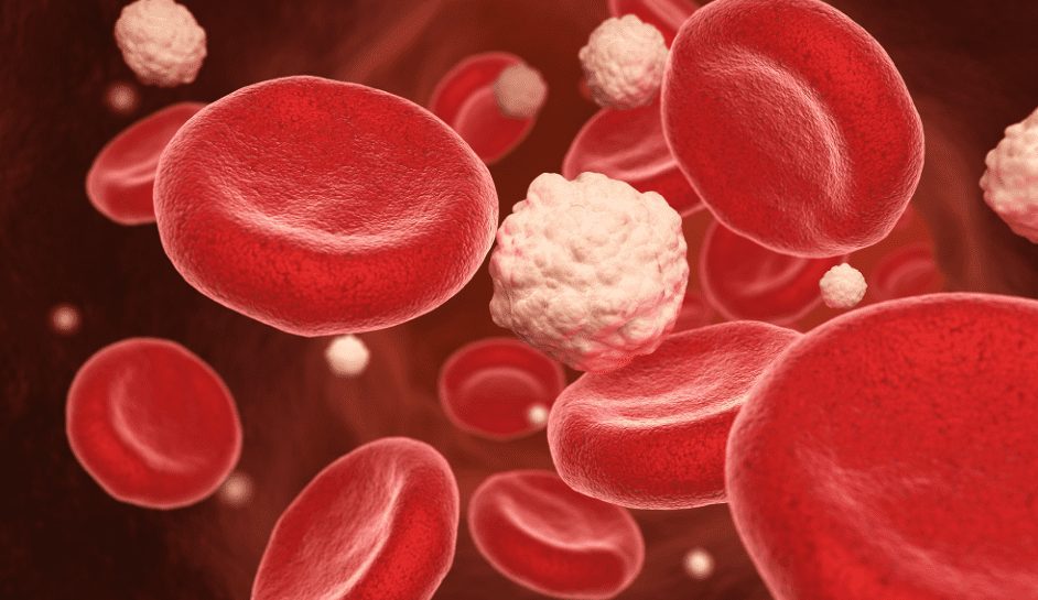High Sugar Diets And Recovery Sugary foods that can slow healing during surgery recovery